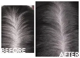 How does Minoxidil Powder work to promote hair growth