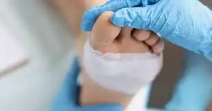 Octenidine Powder Applications