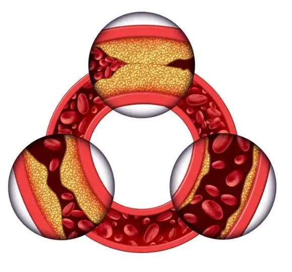 Application Of Atorvastatin powder Application Of Atorvastatin powder