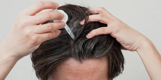 How to Use Minoxidil How to Use Minoxidil