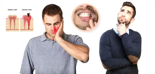 Are there any alternatives to Amoxicillin for treating tooth infections?